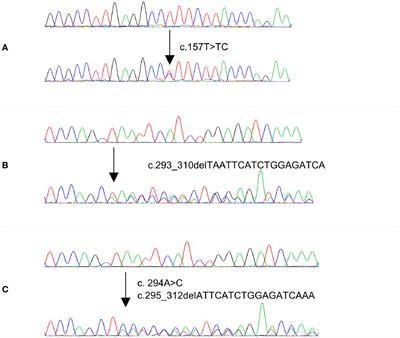 Recurrent Somatic MAP2K1 Mutations in Papillary Thyroid Cancer and Colorectal Cancer